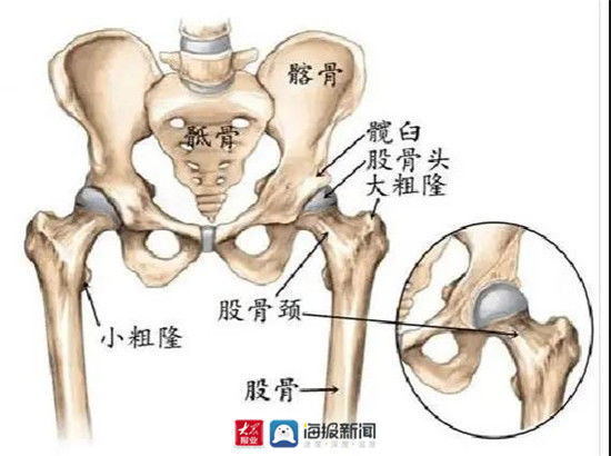 骨三科|冲破高龄手术“禁区” 世博高新医院帮助80岁股骨颈骨折老人重新站起来