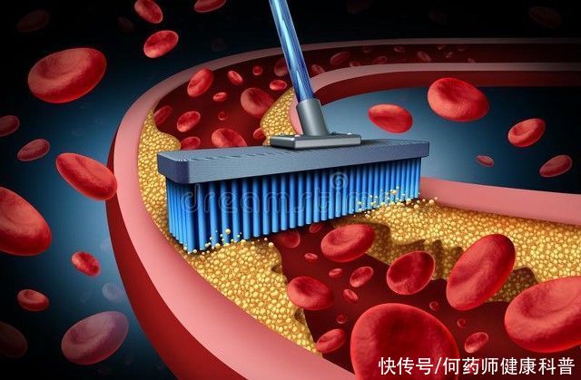 瘀血阻络，经常头痛眩晕、胸痹心痛、失眠多梦，3个成药标本兼治