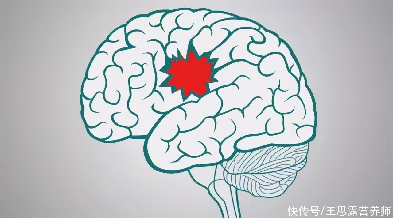  改掉|人过五十，不想脑梗，要改掉4个坏习惯！医生告诉你答案