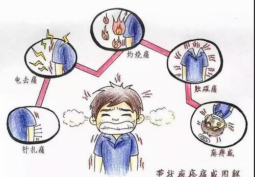 营养神经|甲钴胺片是营养神经的“扛把子”，吃多久能停药？医生正面回答了