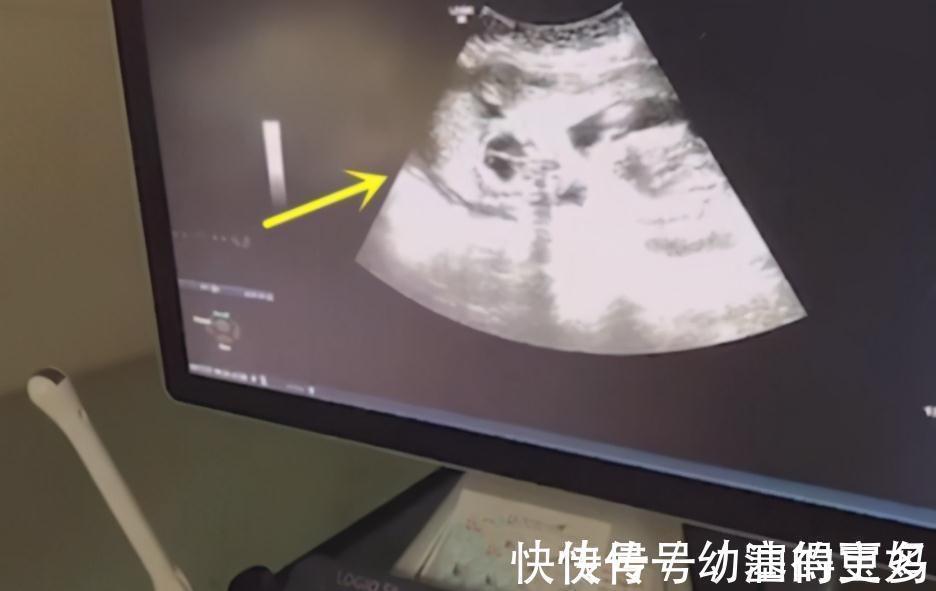意见|10岁男孩哭求妈妈留二胎,逢产检比爸爸还积极,亲自看结果才放心
