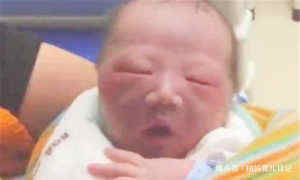 医生|“丑宝宝”被全家人嫌弃,医生却说孩子颜值很高,一个月后奇迹了