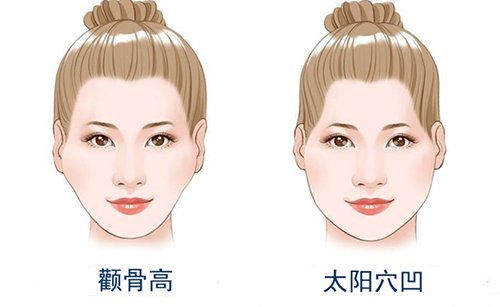 牵拉力|颧骨内推后,面部皮肤一定会下垂吗？看完秒懂