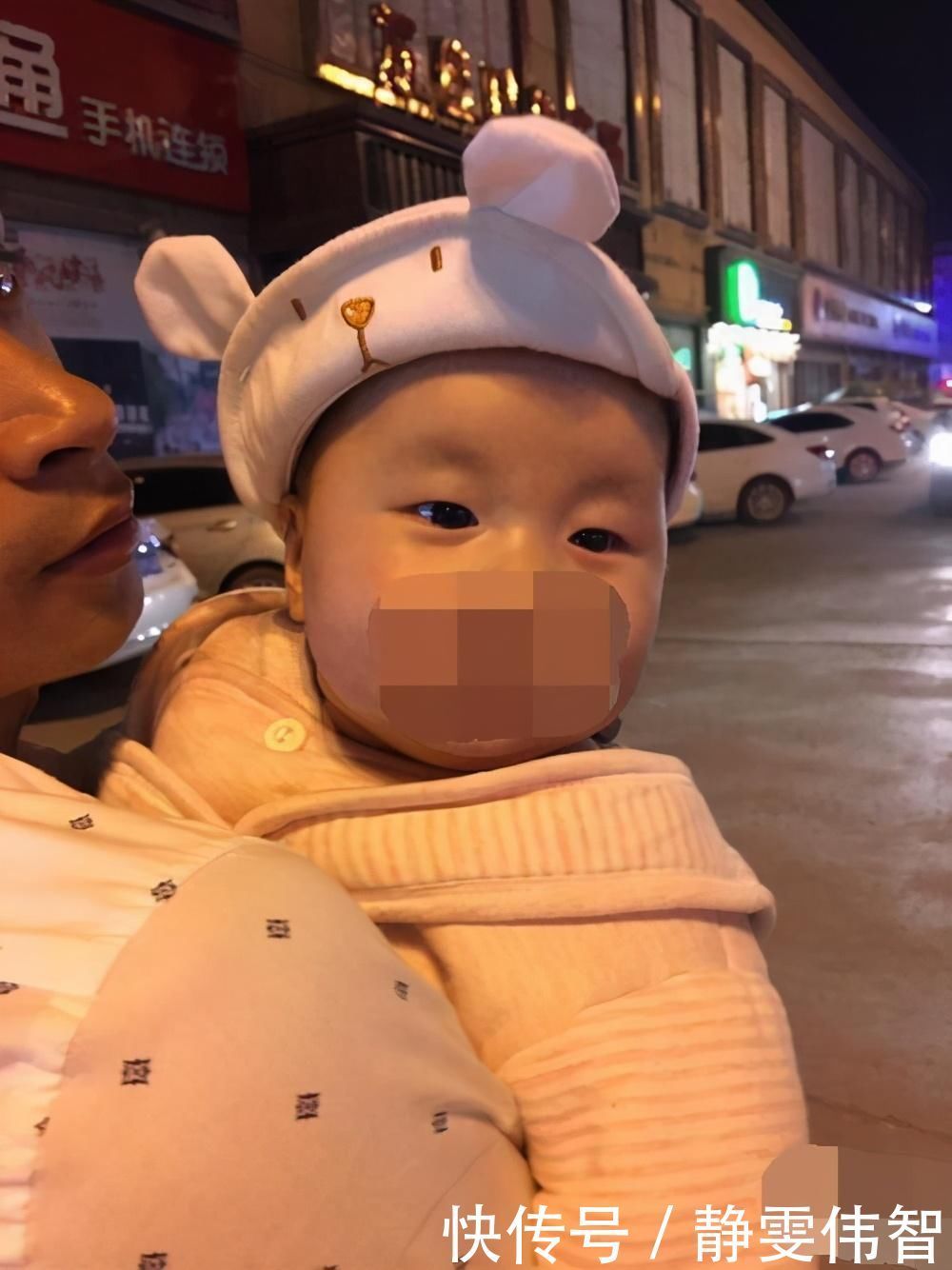 隐性基因|为啥新生儿双眼皮迟迟“不上线”，这3原因是关键，有1种超无奈