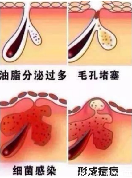 新手|护肤顺序不对，用再贵的神仙水都没用！正确护肤步骤新手别错过