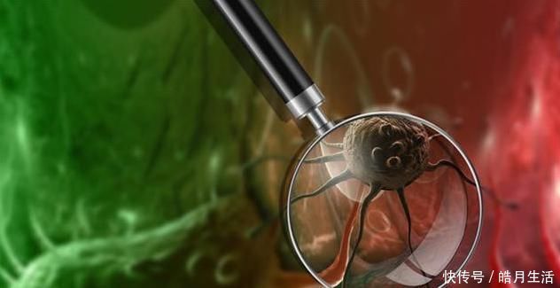 健脾祛湿|一两茯苓一两金，茯苓和它“很般配”，有助健脾祛湿，告别大肚腩