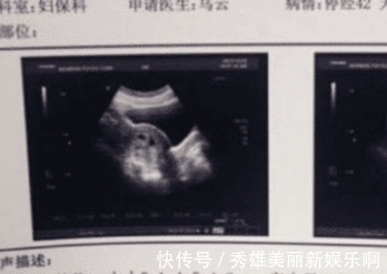 水上乐园|女孩意外怀孕，称是水上乐园“玩水”导致的，得知真相后，双方同时报警