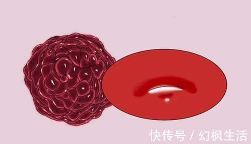 两者|肿瘤不等于癌症,两者到底有什么区别看完就安心了