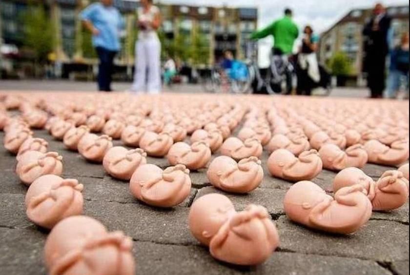 流产|人工拿掉的“胎儿”去哪了?看到这几个处理方式,眼里仿佛进了沙子