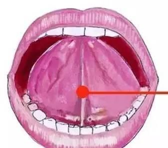 检查|孩子五岁说话不清楚,被说成是大舌头,检查时张开嘴后,医生发怒