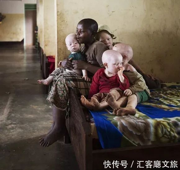 逆袭|因“全身雪白”被遗弃的中国女孩,逆袭成超模的故事让人泪目