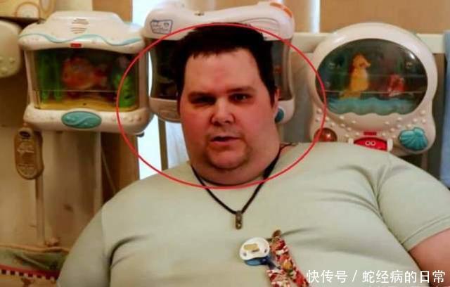 妈妈|32岁“巨婴”每天喝奶粉穿尿布,不然就哭闹,妈妈也办法