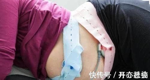 分娩|生孩子时,都会遇到哪些突发情况这6大状况,孕妈不妨先了解下