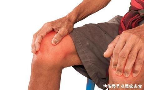 小茴香起大作用不出2周,滑膜炎积液走丢了,膝盖也不疼了