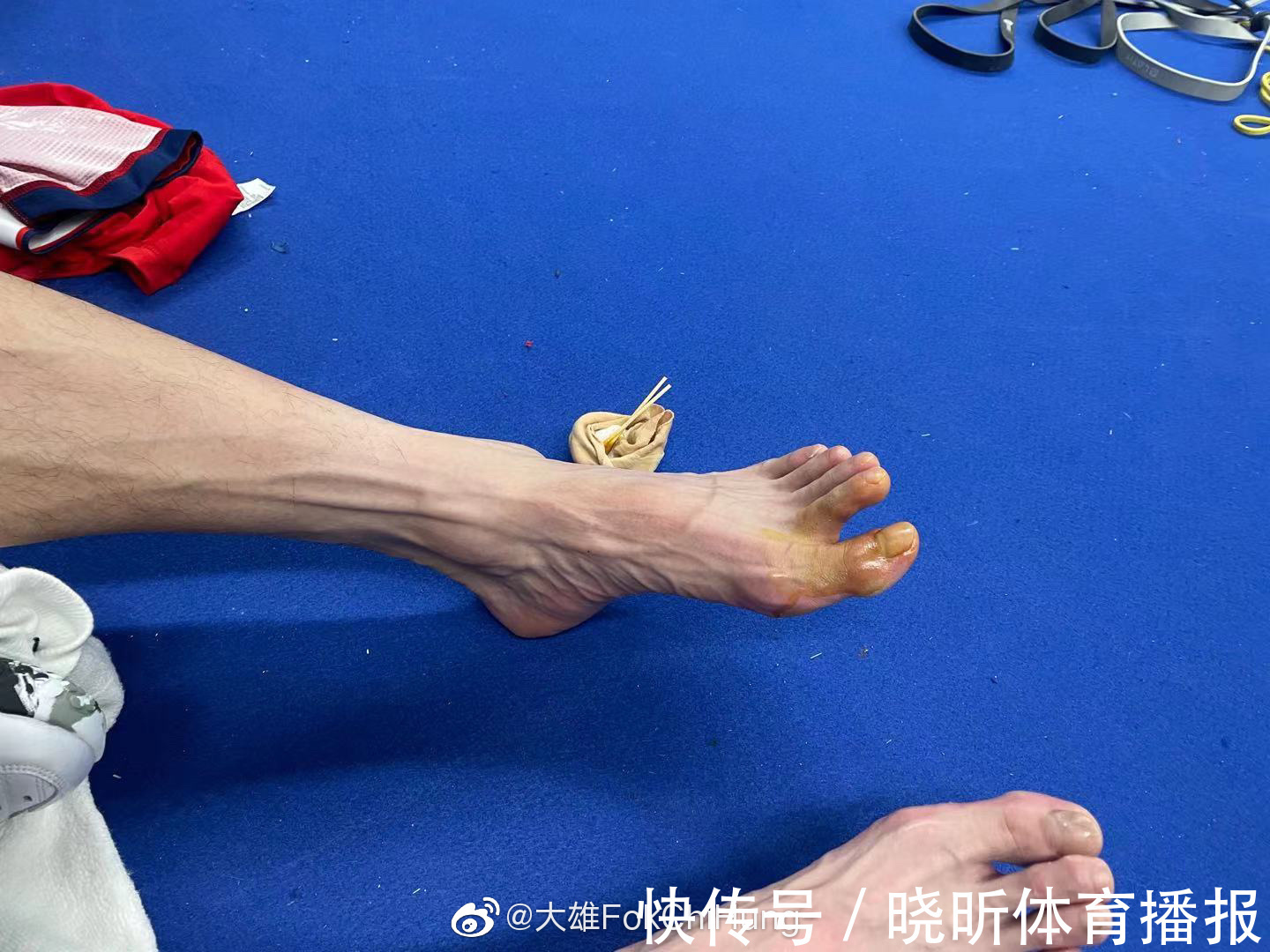 退赛|石宇奇解释为何赛点退赛！首局丢得太可惜，身体哪都疼早想弃权