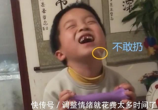 乳牙|原来门牙真的可以“笑”掉，男孩拔牙时头一抬门牙就掉了，一脸懵