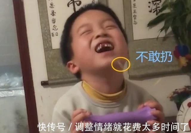 乳牙|原来门牙真的可以“笑”掉,男孩拔牙时头一抬门牙就掉了,一脸懵
