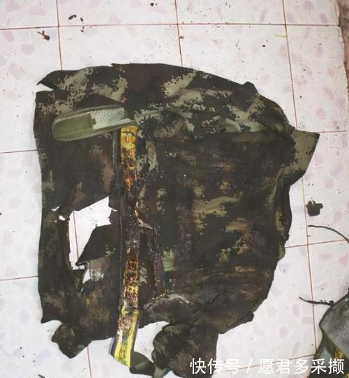 医生|4岁男孩掉进180度油锅,奶奶神操作救了孩子,医生:模范操作