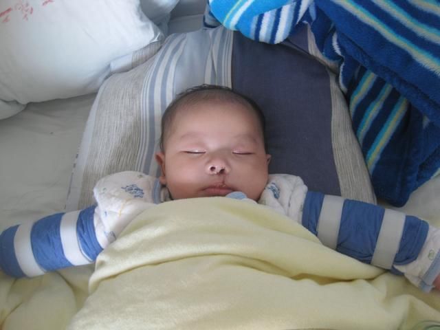 服用药物|产妇生下畸形儿,医生一句话,让宝妈后悔不已是我害了孩子