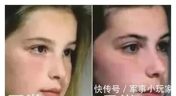 腺样体肥大|孩子家长注意了,这些疾病危害大,寒假请及时排查