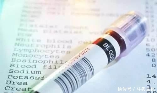 医院都要查血常规、便常规、尿常规,都能查出什么问题?