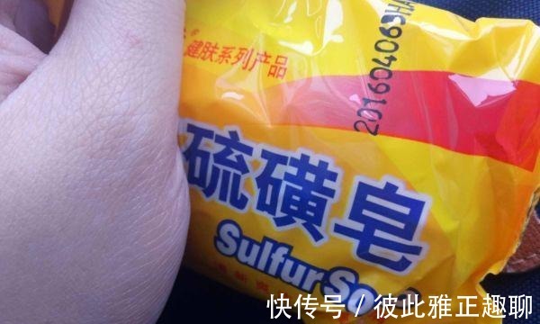 浙江|浙江女性坚持用“硫磺皂水”洗头发,后来得到了啥?多数人想不到