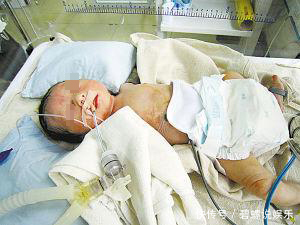 植物人|十四个月大的宝宝吃完饭变成植物人,竟是妈妈的小举动造成的