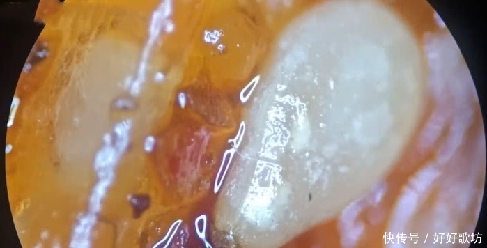 辣条|将辣条放大一百倍,发现了只小动物,网友:为啥辣条有肉