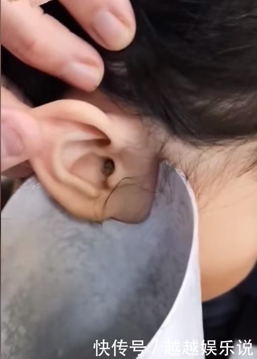 棉花棒|粗心妈妈以为孩子反应迟钝原来是耳垢填满耳朵,导致孩子听不到