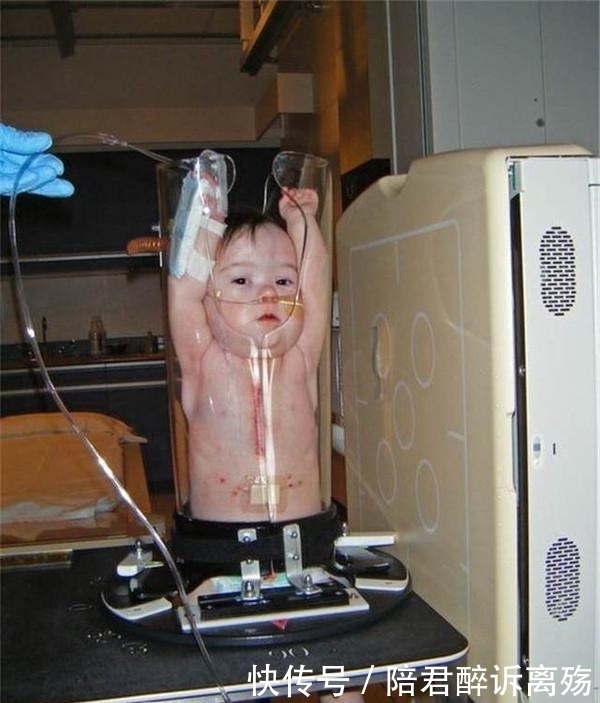 真相|网友看到婴孩被塞进这种“透明玻璃瓶”,有些气愤,得知真相点赞