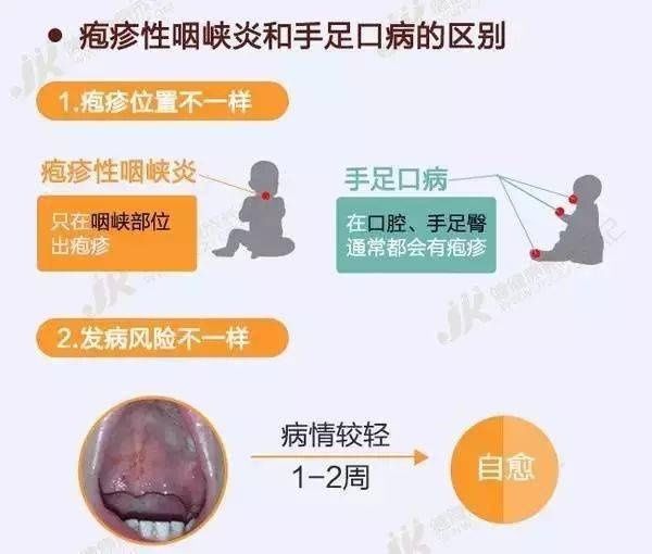 疱疹|【卫生保健】正确认识手足口病和疱疹性咽峡炎