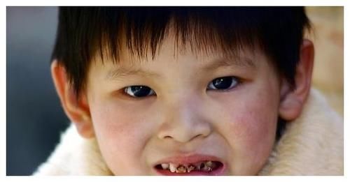 龋齿|孩子换牙期不能吃这3种食物,父母要知道!