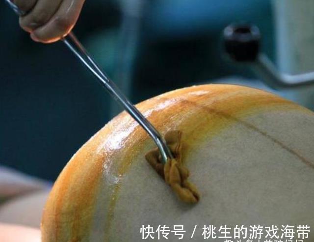 怀孕|剖腹产时,能让医生顺便割掉点“脂肪”吗?大多数人难想到