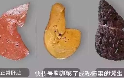 肝脏健康|想养肝的人,通常可以多吃这6种水果,做好2件事,或有助于肝健康