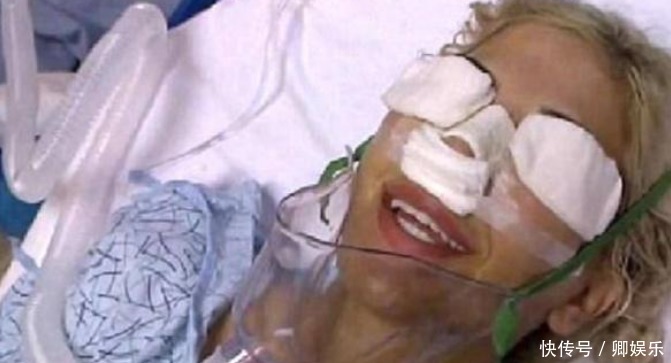 女子花重金整容，一年经历13次整容手术，整容前后判若两人！