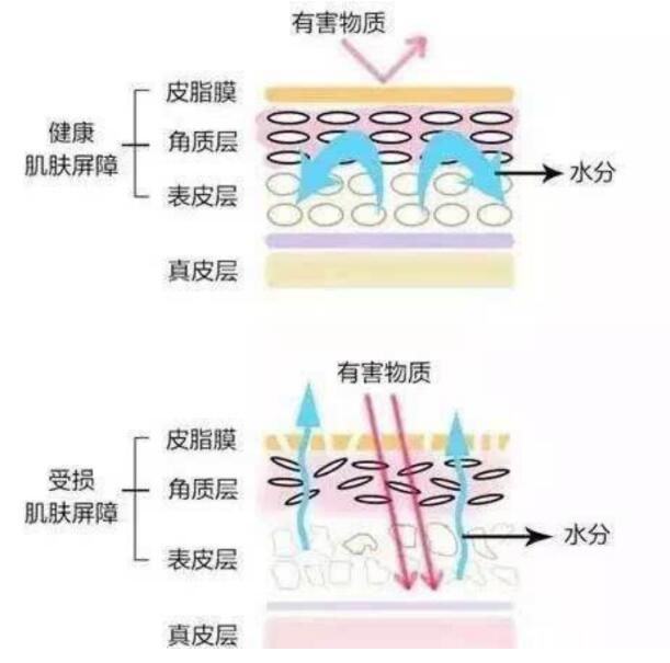 皮肤 敏感肌、干皮救星神经酰胺，究竟怎么用才有效？