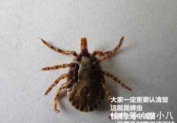 种病毒|爸爸帮女儿梳头,头皮上现白色“小球”,医生拔出后大开眼界