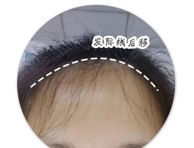 圆脸 别再留显脸大的发型了!这2款,照着剪美炸了丨粉丝发型改造