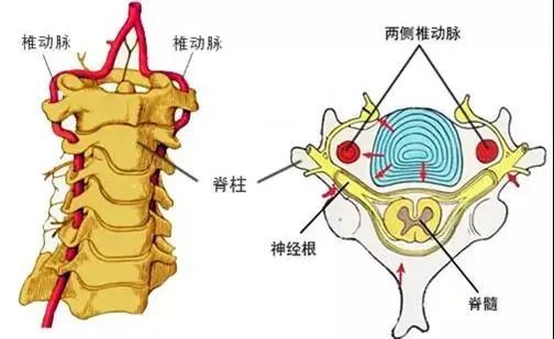 颈椎病|26岁小伙患脑梗！只因这件很多人都在做的事？