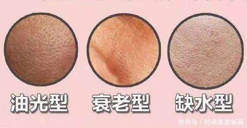 me胶原蛋白:皮肤太油怎么办?教你去油控油小妙招