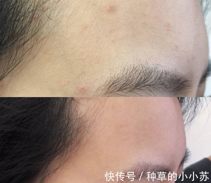 伪科学|皂基洗面奶真的毁脸吗，氨基酸一定就好用吗，别再相信这些伪科学