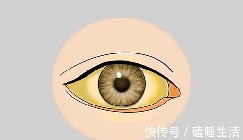 异常|肝癌不会突然发生！医生：身体会给3次机会，若不抓住，后悔莫及