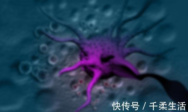 患癌|一生不得癌的人,除了幸运外,或许和4个好习惯有关!