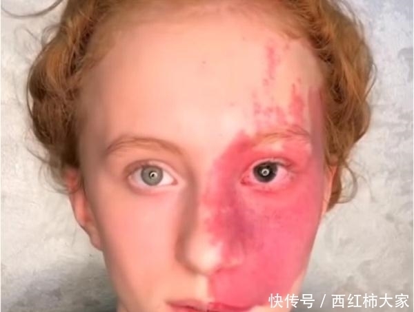 惊艳|半张脸都是胎记,化妆后却美到惊艳!网友:化妆师太厉害了
