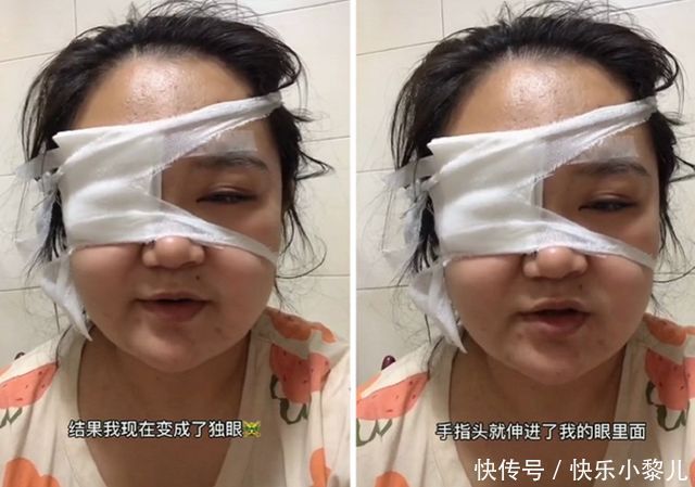 宝妈|小宝宝杀伤力有多强?宝妈:我为你剖腹7层,你却让我变“独眼”