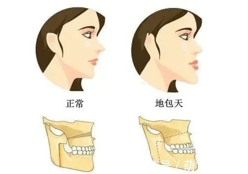 发育|何时给宝宝戒奶瓶？晚于这个时间，危害不止一点点！