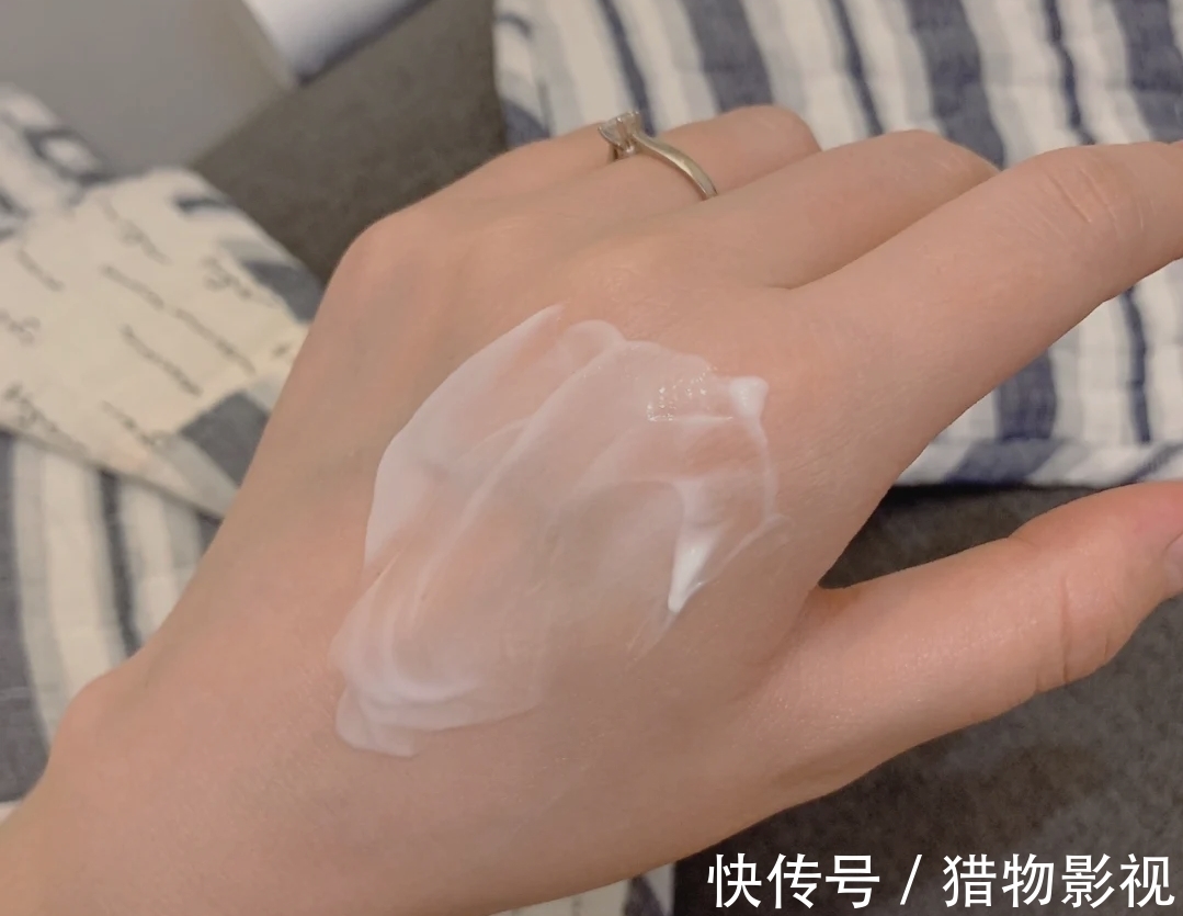 孕期|这几类幸运孕妈最不容易长妊娠纹?医生直言:确实如此