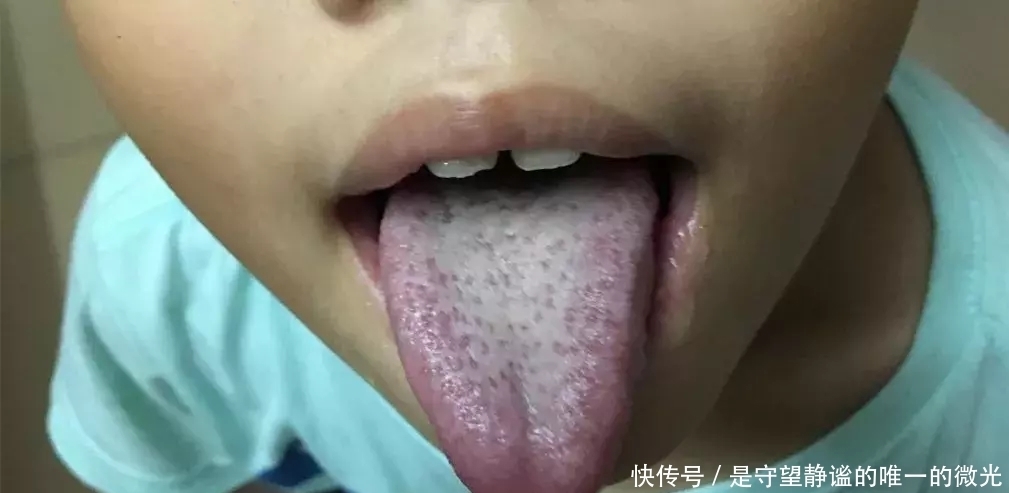 便秘|长期便秘,羊屎蛋,便秘腹泻交替的根本原因
