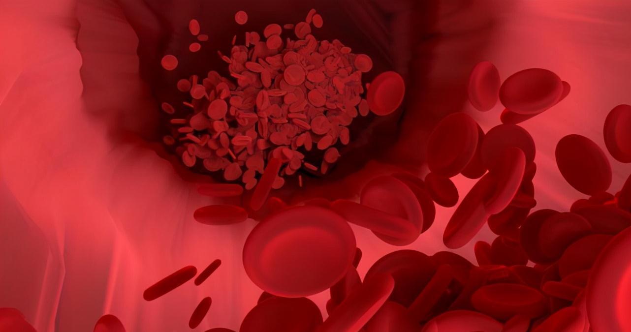 甘油三酯|馒头吃多了血脂会超标?医生:若想血脂降低,少吃3类“素食”