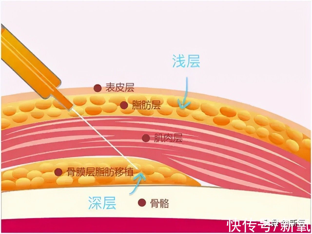 氧叔 40岁的她美商绝了